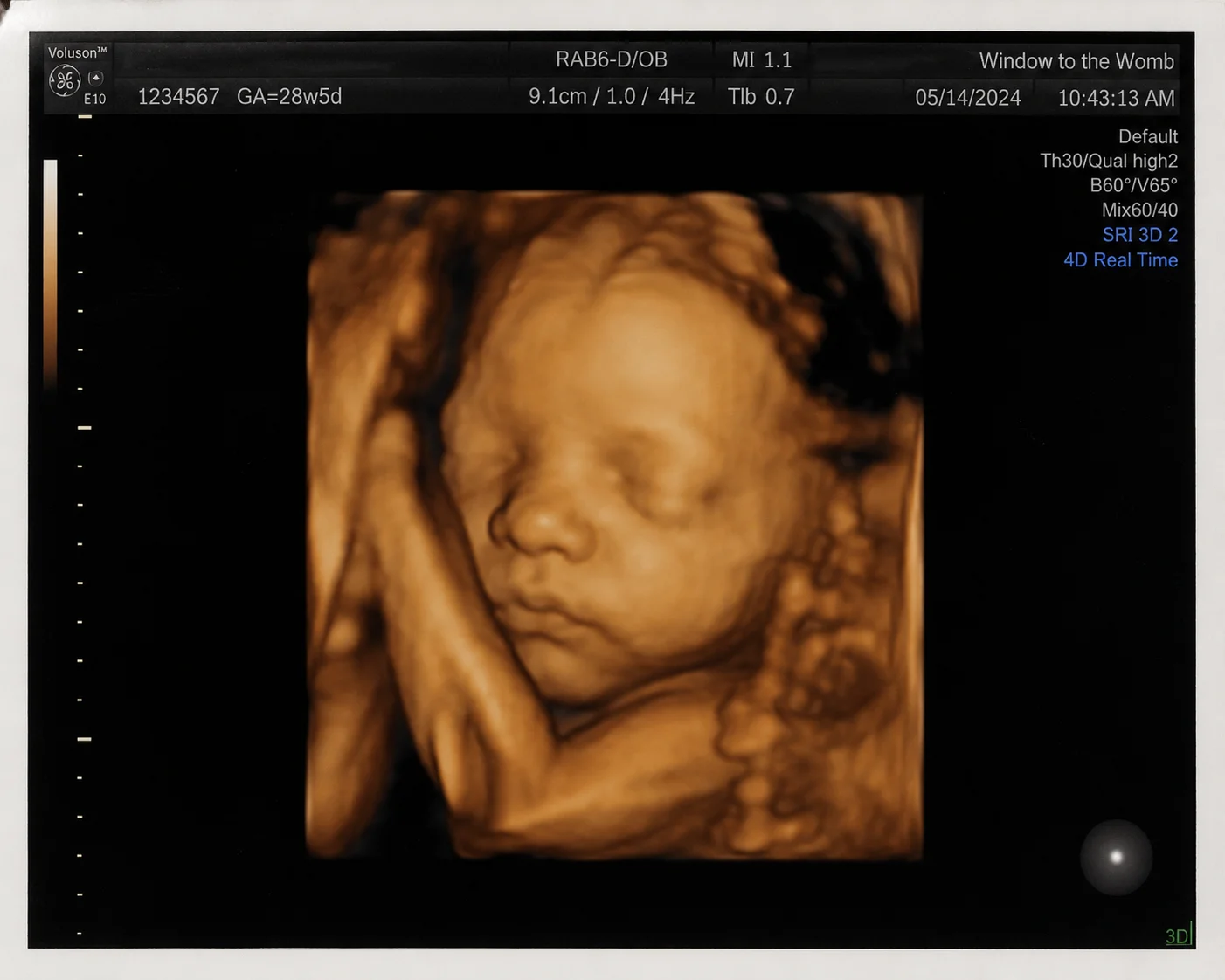 3D ultrasound image of a baby at Signal View Ultrasound in Las Vegas